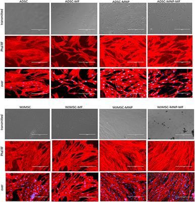 Magnetic Nanoparticles and Magnetic Field Exposure Enhances Chondrogenesis of Human Adipose Derived Mesenchymal Stem Cells But Not of Wharton Jelly Mesenchymal Stem Cells